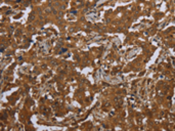 Rabbit Polyclonal Antibody to SCGB1D2