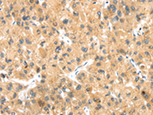 Rabbit Polyclonal Antibody to LLGL2
