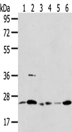 Rabbit Polyclonal Antibody to PSMB8