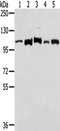 Rabbit Polyclonal Antibody to LONP1