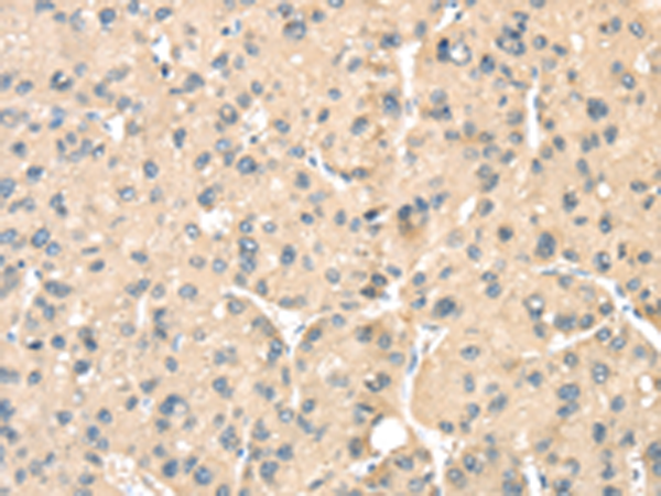 Rabbit Polyclonal Antibody to LOXL3