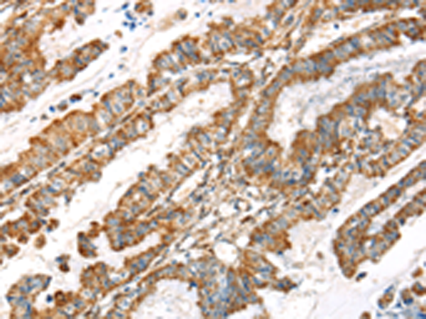 Rabbit Polyclonal Antibody to LOXL4