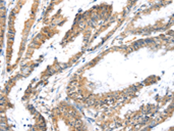 Rabbit Polyclonal Antibody to LZTS1