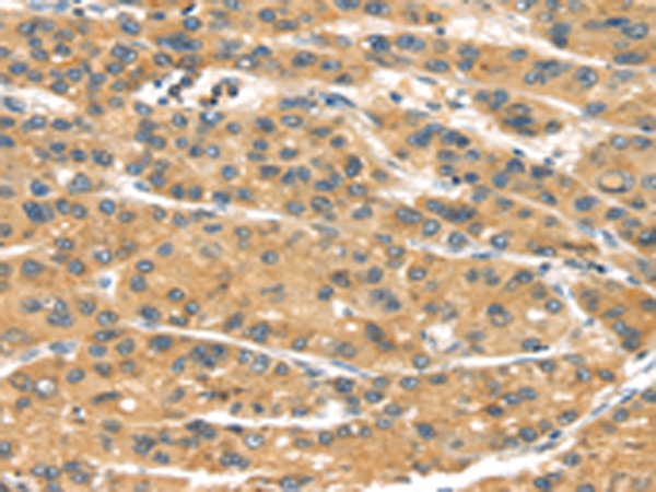 Rabbit Polyclonal Antibody to MACC1