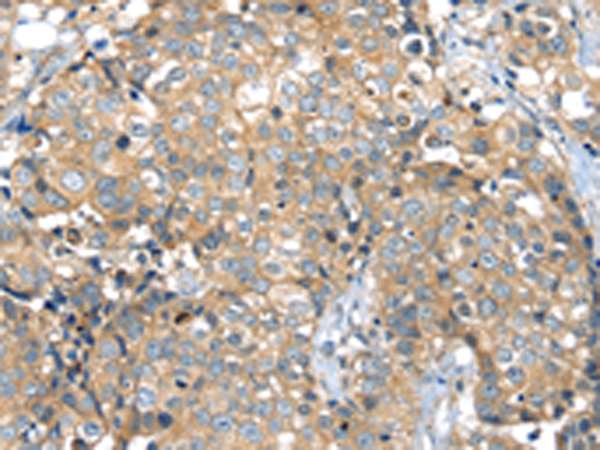 Rabbit Polyclonal Antibody to MAGEA11