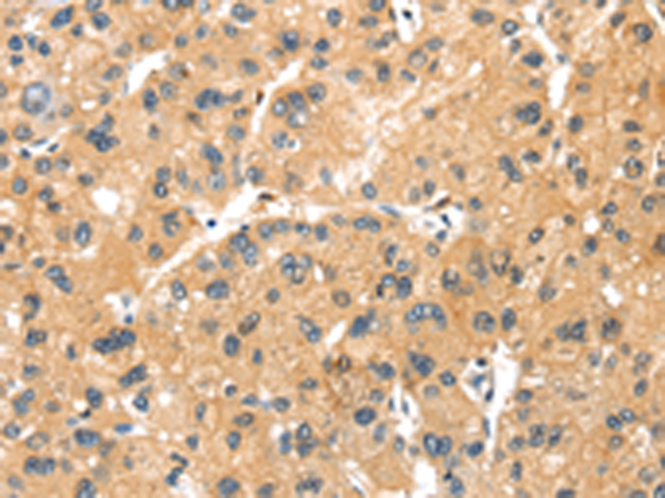 Rabbit Polyclonal Antibody to MAGEB2