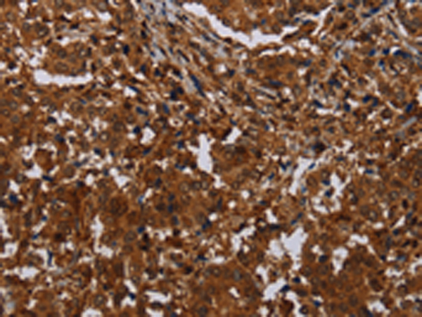 Rabbit Polyclonal Antibody to MAGEB18