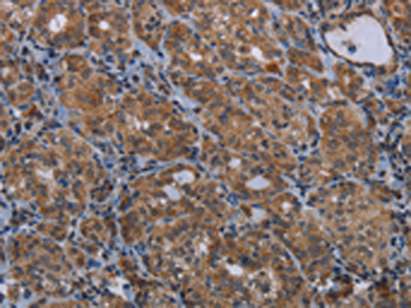 Rabbit Polyclonal Antibody to MAGEE1