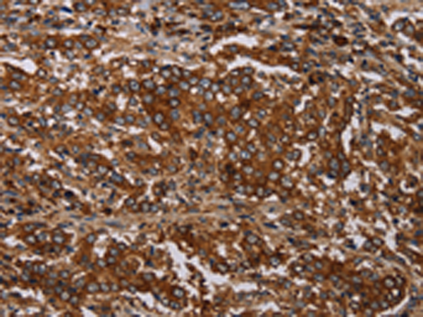 Rabbit Polyclonal Antibody to MAGEC2