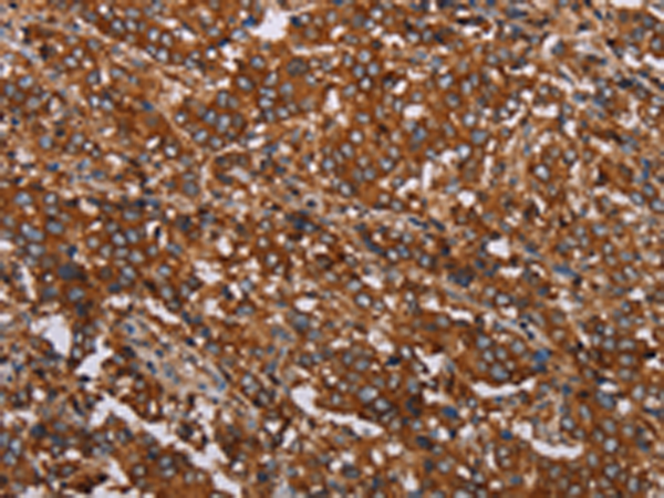 Rabbit Polyclonal Antibody to MFAP5