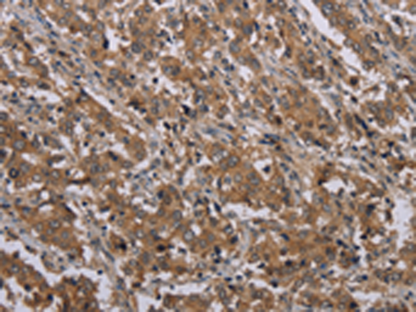 Rabbit Polyclonal Antibody to MAL
