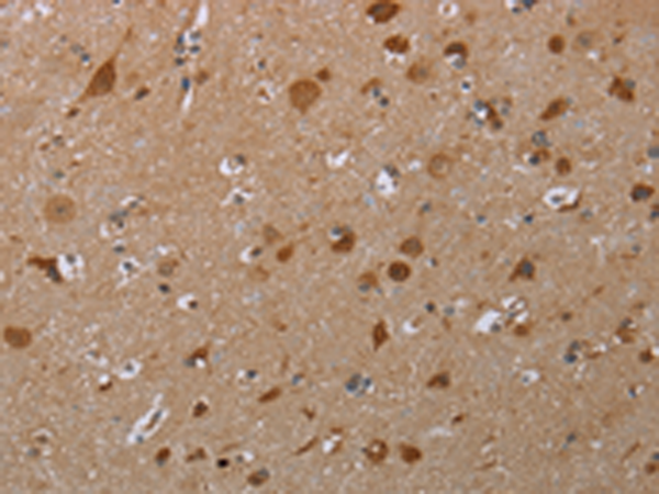 Rabbit Polyclonal Antibody to MARK1