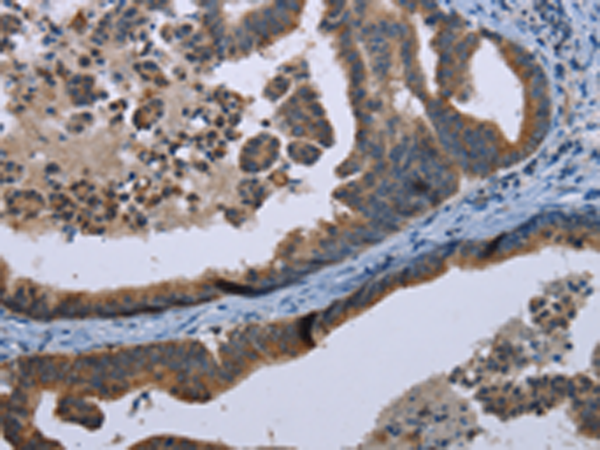 Rabbit Polyclonal Antibody to MARK4