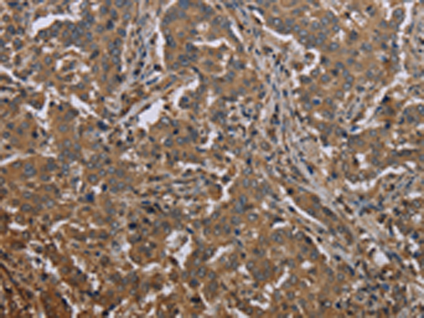 Rabbit Polyclonal Antibody to MCC