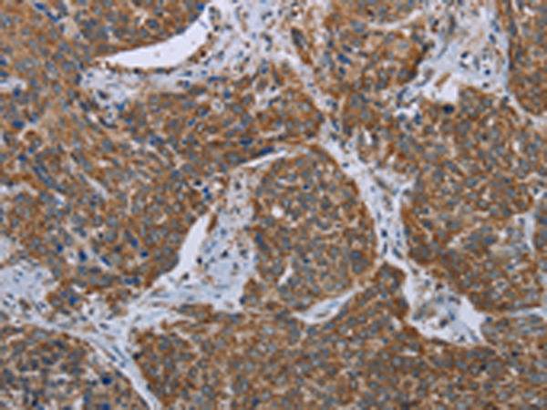 Rabbit Polyclonal Antibody to MDFIC