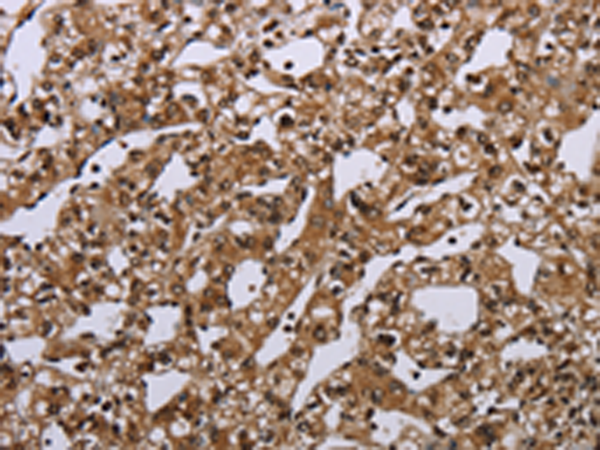 Rabbit Polyclonal Antibody to MEIS1