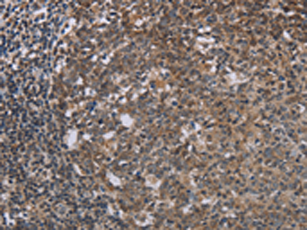 Rabbit Polyclonal Antibody to TBX5