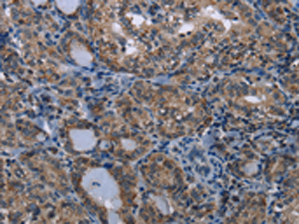 Rabbit Polyclonal Antibody to TRPV1
