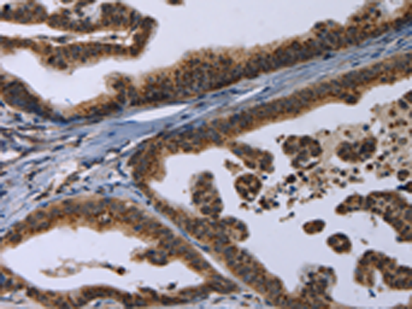 Rabbit Polyclonal Antibody to REG3A