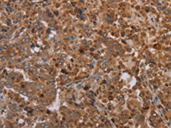 Rabbit Polyclonal Antibody to REG3A