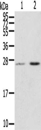 Rabbit Polyclonal Antibody to MIG7