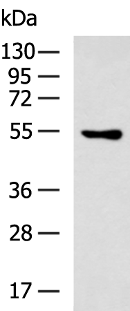 Rabbit Polyclonal Antibody to ERRFI1