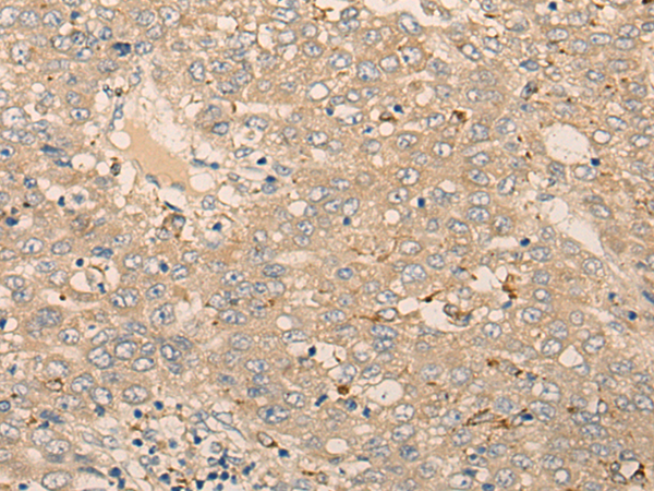 Rabbit Polyclonal Antibody to MIIP