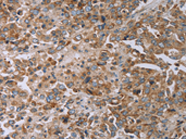 Rabbit Polyclonal Antibody to TNPO1