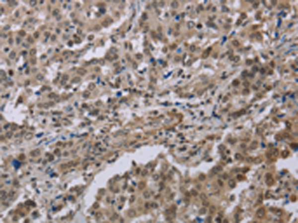 Rabbit Polyclonal Antibody to MGLL