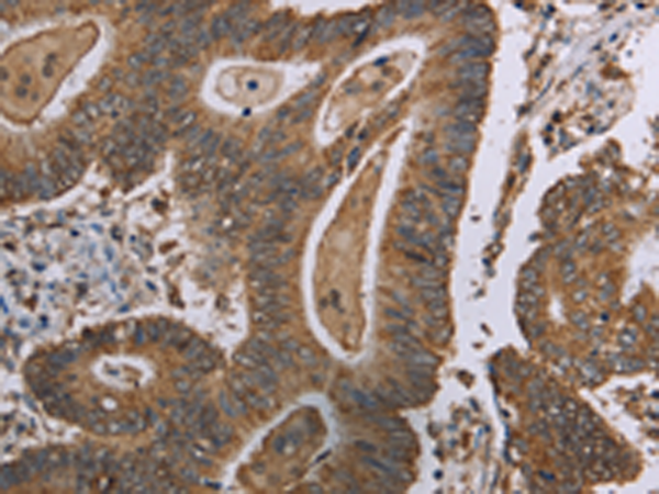 Rabbit Polyclonal Antibody to MRGPRX1