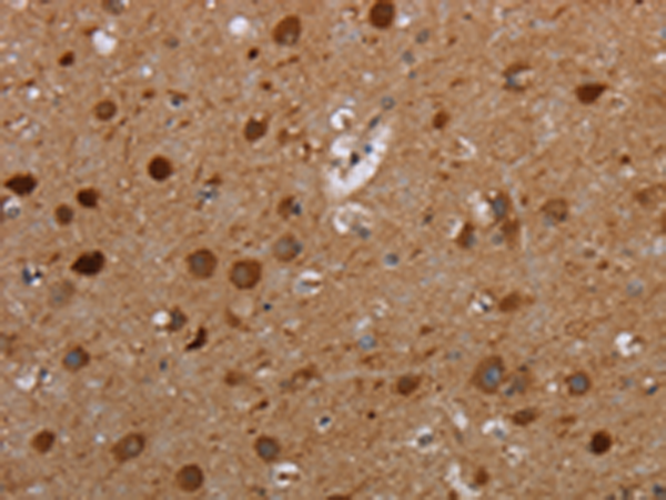 Rabbit Polyclonal Antibody to MTBP