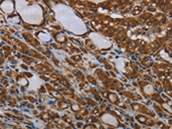 Rabbit Polyclonal Antibody to MT-ND1