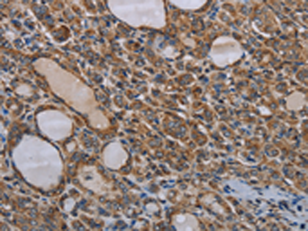 Rabbit Polyclonal Antibody to MT-ND6