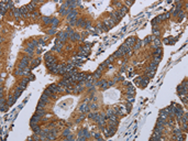 Rabbit Polyclonal Antibody to MT-ND3
