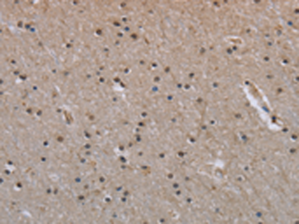 Rabbit Polyclonal Antibody to MVD