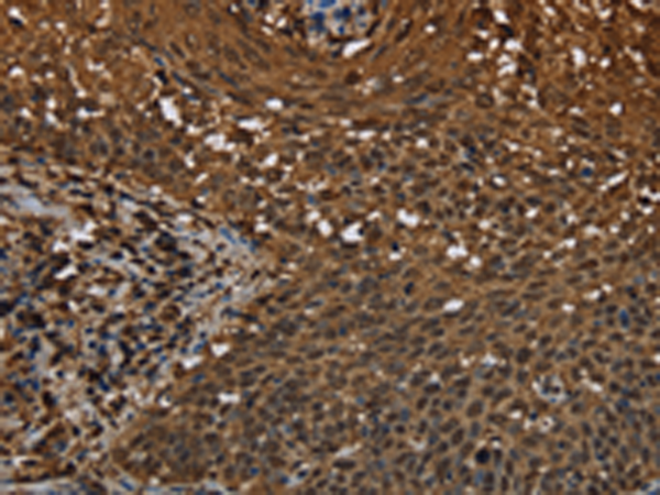 Rabbit Polyclonal Antibody to MYBBP1A