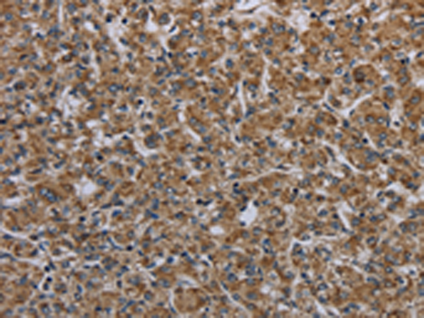 Rabbit Polyclonal Antibody to MYO7A