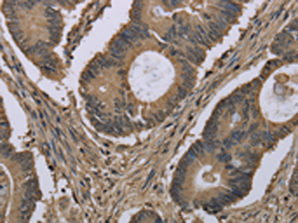 Rabbit Polyclonal Antibody to MYO18B