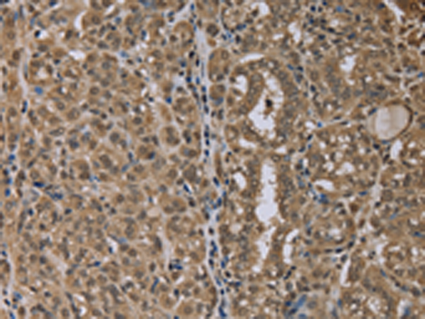 Rabbit Polyclonal Antibody to NLRP6