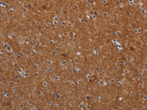 Rabbit Polyclonal Antibody to NCKAP1