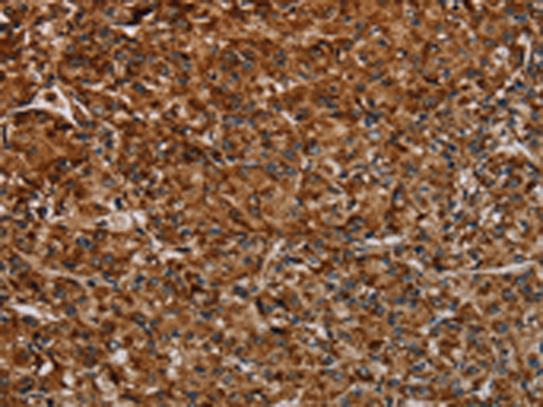 Rabbit Polyclonal Antibody to NDUFAB1