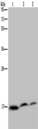 Rabbit Polyclonal Antibody to NDUFAF4