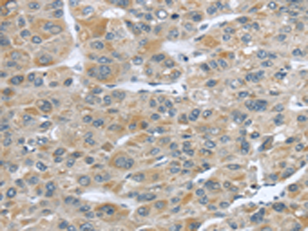 Rabbit Polyclonal Antibody to CFAP45