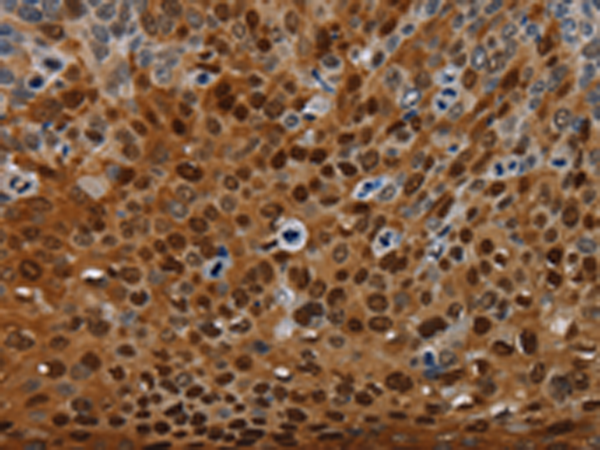 Rabbit Polyclonal Antibody to NRP2