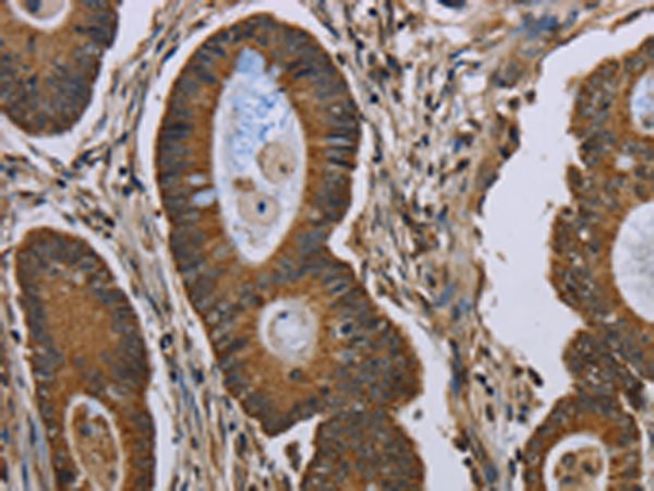 Rabbit Polyclonal Antibody to NEFH