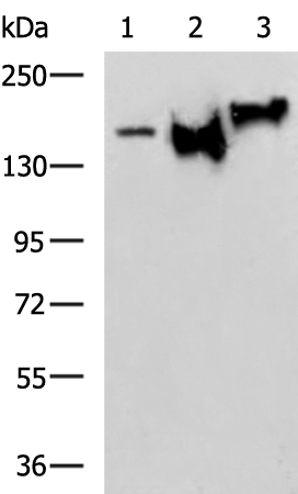 Rabbit Polyclonal Antibody to NEFM