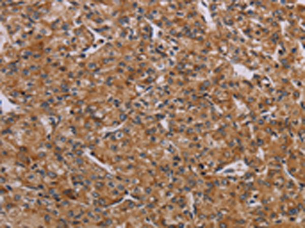 Rabbit Polyclonal Antibody to AATK