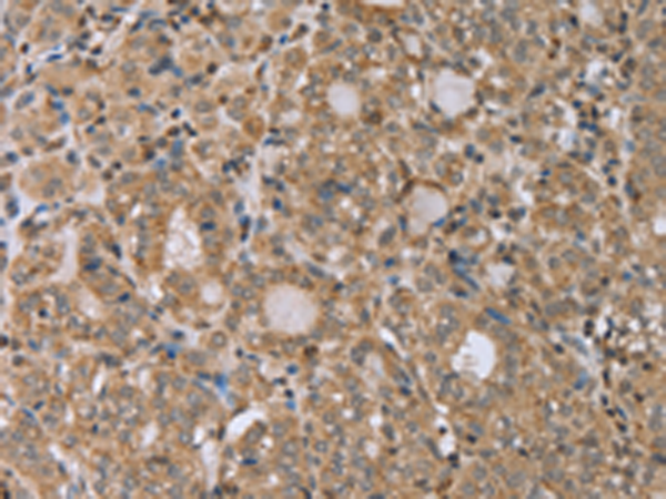 Rabbit Polyclonal Antibody to RAB39B