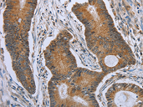 Rabbit Polyclonal Antibody to TNFRSF13C