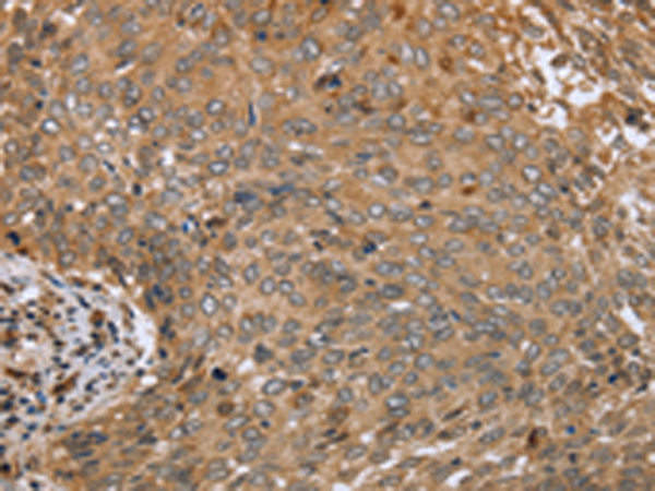 Rabbit Polyclonal Antibody to CLEC16A